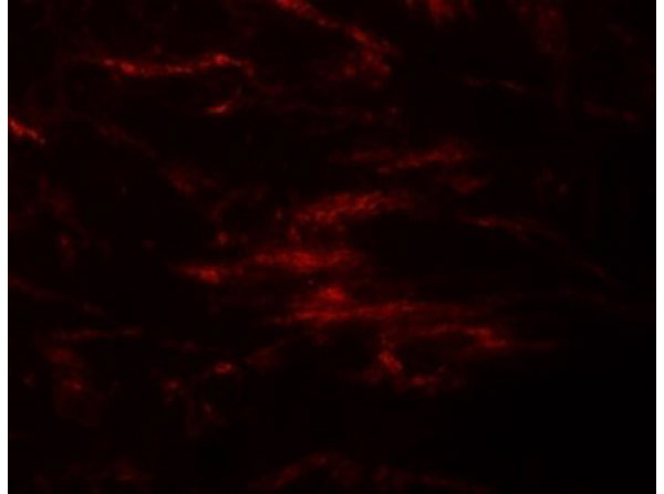 ZIP2 Antibody in Immunocytochemistry (ICC/IF)