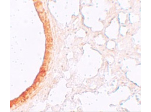 ZIP3 Antibody in Immunohistochemistry (Paraffin) (IHC (P))