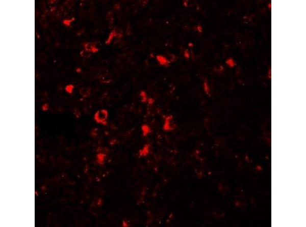 ZIP5 Antibody in Immunocytochemistry (ICC/IF)