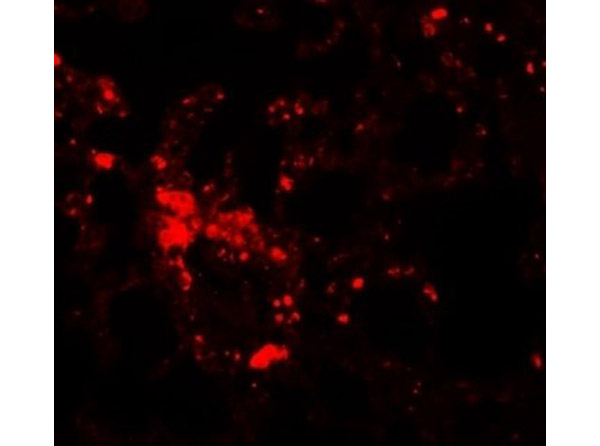 ZIP6 Antibody in Immunocytochemistry (ICC/IF)