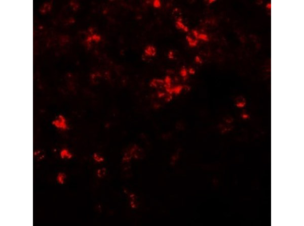 ZIP8 Antibody in Immunocytochemistry (ICC/IF)