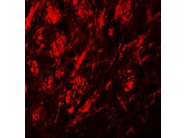 ZIP9 Antibody in Immunocytochemistry (ICC/IF)