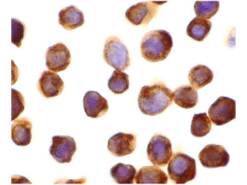 ZIPK Antibody in Immunocytochemistry (ICC/IF)