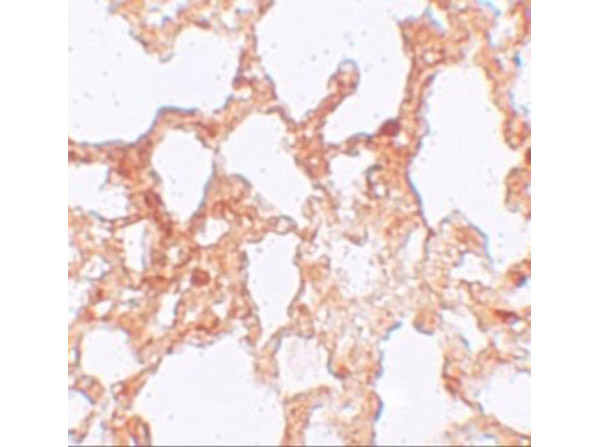 ZMYM1 Antibody in Immunohistochemistry (Paraffin) (IHC (P))