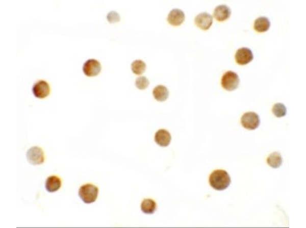 ZMYM2 Antibody in Immunocytochemistry (ICC/IF)