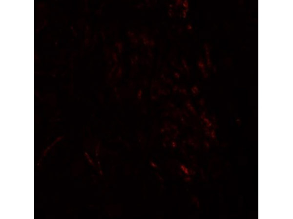 ZMYM3 Antibody in Immunocytochemistry (ICC/IF)