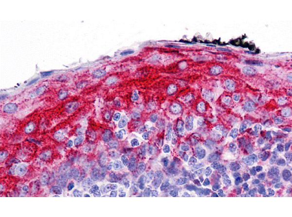 ZMYM4 Antibody in Immunohistochemistry (Paraffin) (IHC (P))