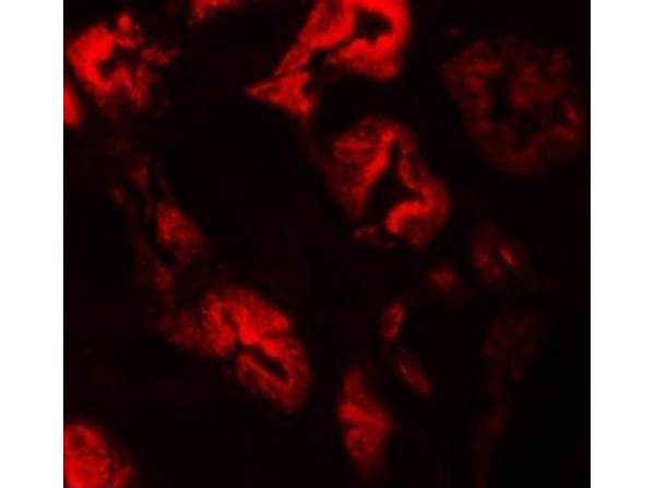 ZNF346 (CT) Antibody in Immunocytochemistry (ICC/IF)