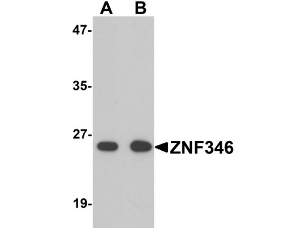 ZNF346 Antibody in Western Blot (WB)