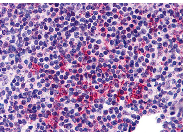 ZNF687 Antibody in Immunohistochemistry (Paraffin) (IHC (P))