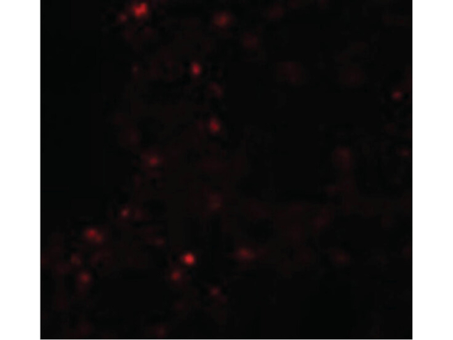 ZSCAN4 Antibody in Immunocytochemistry (ICC/IF)