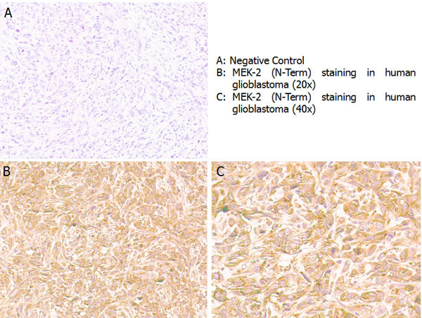 MEK2 N-Term Antibody in Immunohistochemistry (Paraffin) (IHC (P))