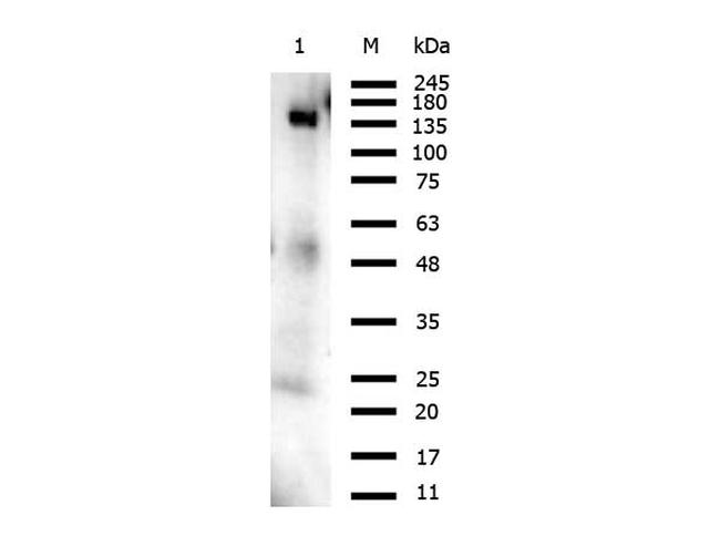 Orf2 Antibody in Western Blot (WB)