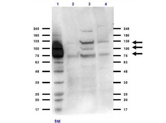 Integrin beta 3 Antibody in Western Blot (WB)