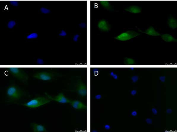 ATF6 Antibody in Immunocytochemistry (ICC/IF)