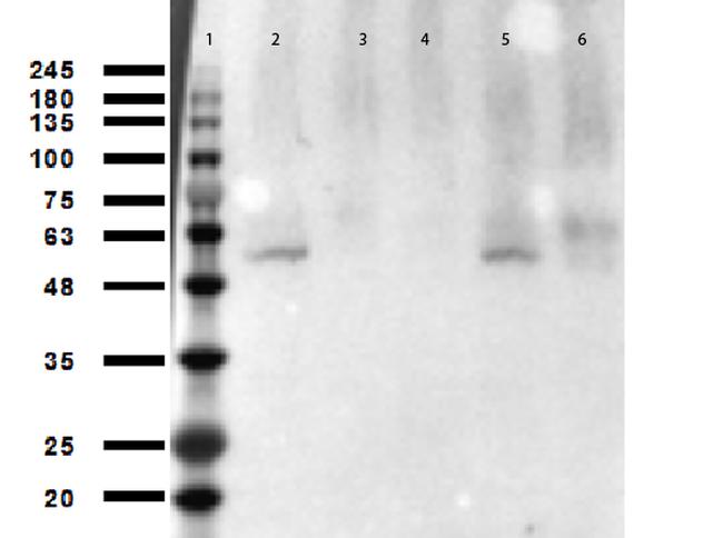 Acetyl-p53 (Lys305) Antibody in Western Blot (WB)