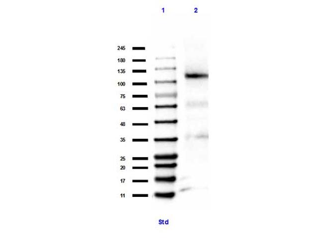 Methyl-Retinoblastoma (Lys860) Antibody in Western Blot (WB)