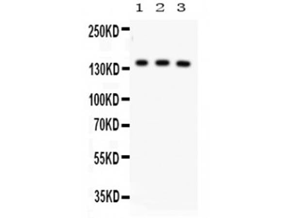ABCB11 Antibody in Western Blot (WB)