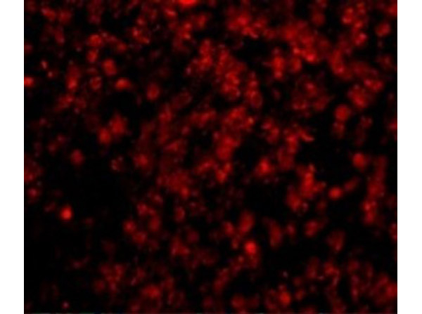 LIPE Antibody in Immunocytochemistry (ICC/IF)