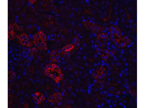 Nephrin Antibody in Immunocytochemistry (ICC/IF)