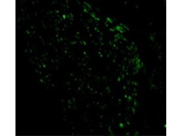 Noxa Antibody in Immunocytochemistry (ICC/IF)