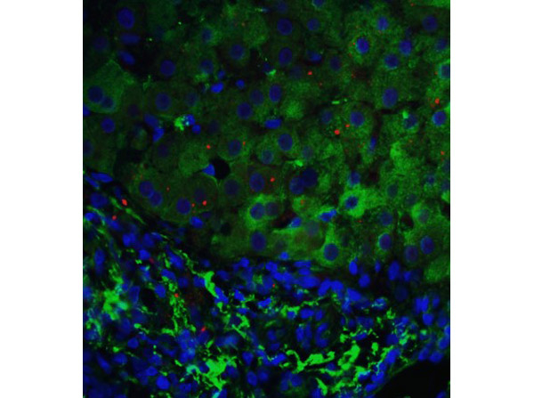 p53DINP1 Antibody in Immunocytochemistry (ICC/IF)