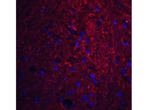 PION Antibody in Immunocytochemistry (ICC/IF)