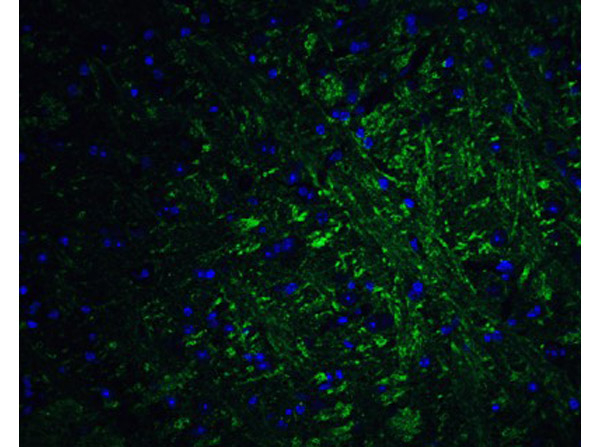 PRDM16 Antibody in Immunocytochemistry (ICC/IF)