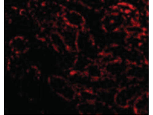 RIP3 Antibody in Immunocytochemistry (ICC/IF)