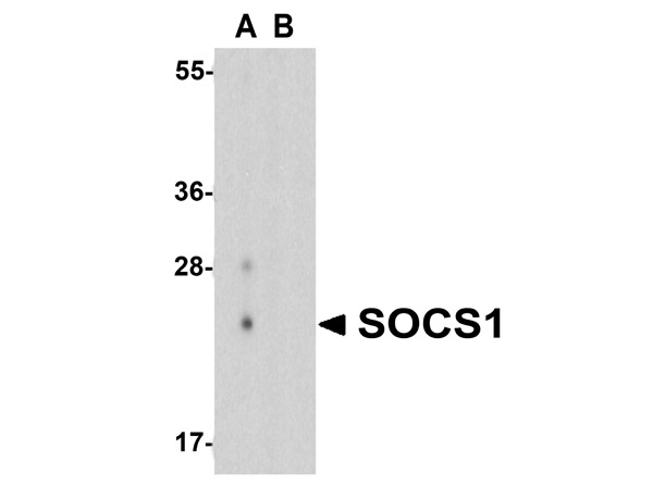 SOCS1 Antibody in Western Blot (WB)