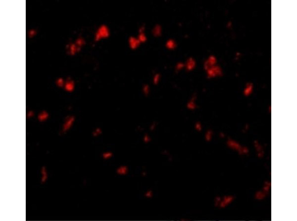 Spred1 Antibody in Immunocytochemistry (ICC/IF)