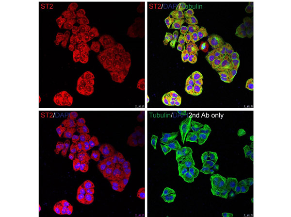 ST2 Antibody in Immunocytochemistry (ICC/IF)
