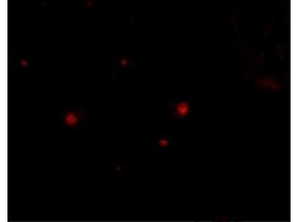 STIM2 Antibody in Immunocytochemistry (ICC/IF)