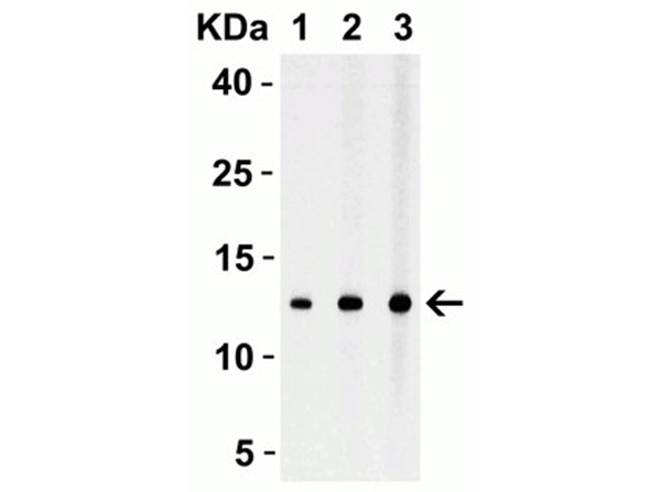 Strep-tag II Antibody in Western Blot (WB)