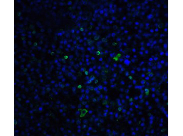 TLR3 Antibody in Immunocytochemistry (ICC/IF)