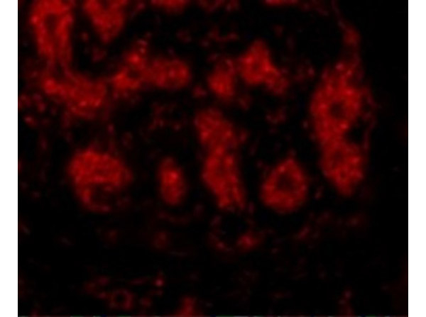 TRIM5 alpha Antibody in Immunocytochemistry (ICC/IF)
