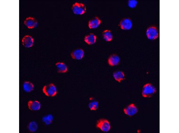 TRPC6 Antibody in Immunocytochemistry (ICC/IF)