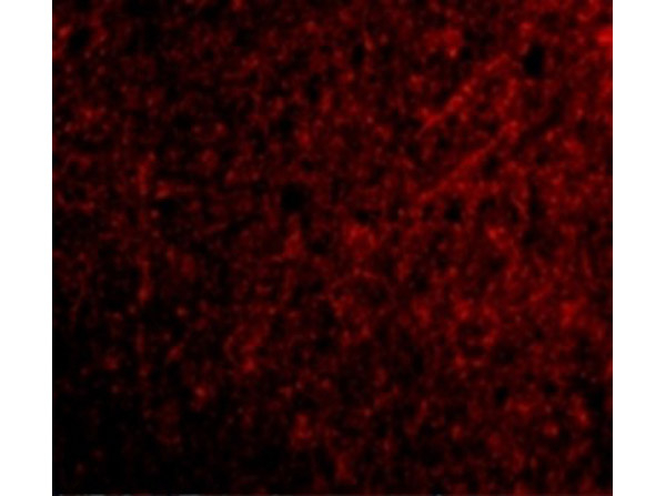 TSLP Antibody in Immunocytochemistry (ICC/IF)