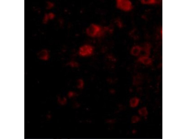 VGF Antibody in Immunocytochemistry (ICC/IF)