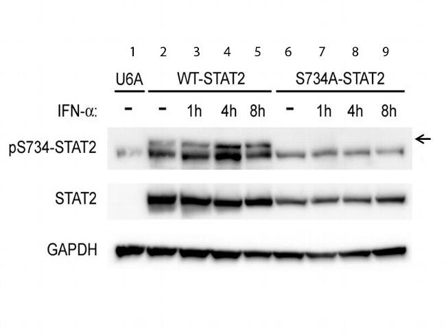 Phospho-STAT2 (Ser734) Antibody in Western Blot (WB)