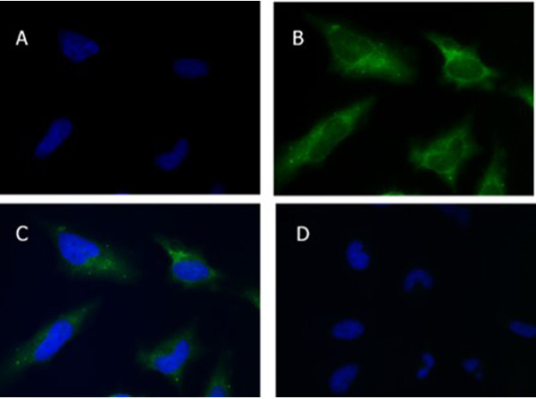 SQSTM1/p62 Antibody in Immunocytochemistry (ICC/IF)
