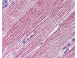 RAB7 Antibody in Immunohistochemistry (Paraffin) (IHC (P))