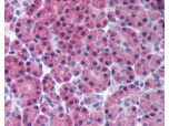 Receptor-interacting serine-threonine kinase 3 Antibody in Immunohistochemistry (Paraffin) (IHC (P))