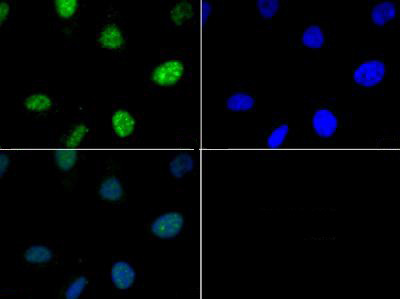 Phospho-Histone H3 (Thr6) Antibody in Immunocytochemistry (ICC/IF)