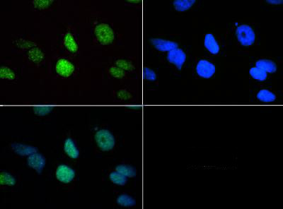 H3K18me3 Antibody in Immunocytochemistry (ICC/IF)