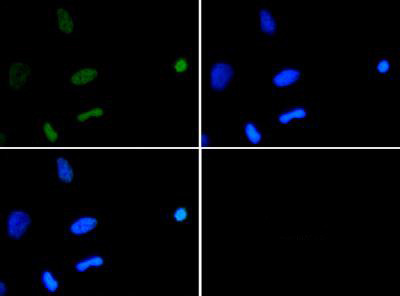 H3K18ac Antibody in Immunocytochemistry (ICC/IF)