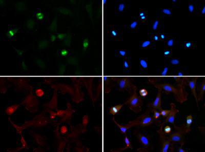 H3K56me3 Antibody in Immunocytochemistry (ICC/IF)