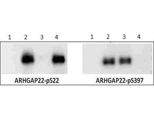 Phospho-Arhgap22 (Ser22) Antibody in Western Blot (WB)