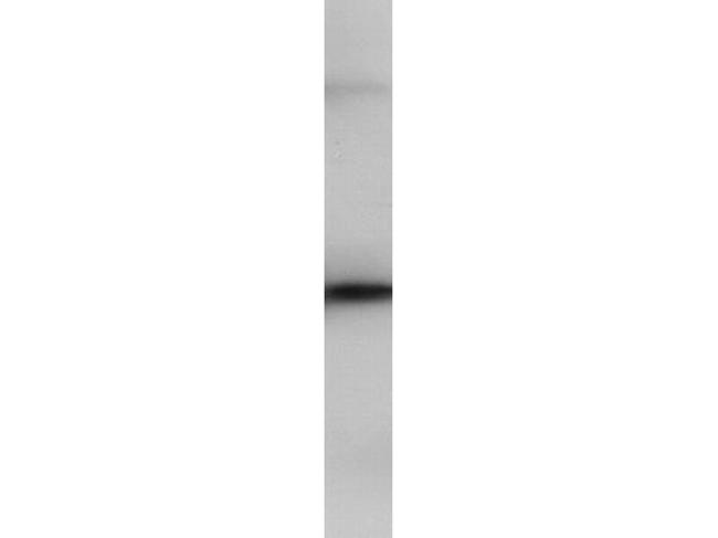 PIP5K2B Antibody in Western Blot (WB)