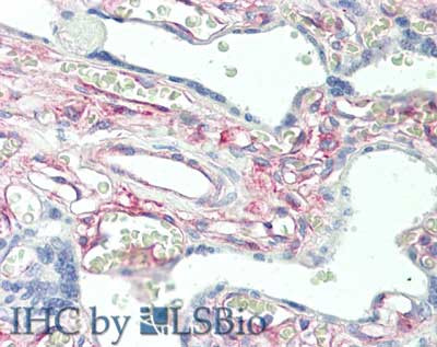 Protein Kinase C delta-Binding Protein Antibody in Immunohistochemistry (Paraffin) (IHC (P))